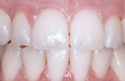 Croppedimage330130 Crowded After