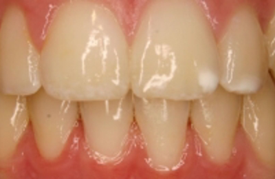 Croppedimage330130 Fangy After